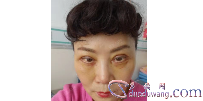 1717597172517766.png image.png