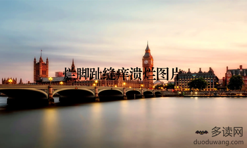 烂脚趾缝痒溃烂图片